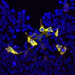 Cas9 Antibody in Immunocytochemistry (ICC/IF)