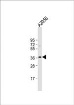 IGHA1 Antibody in Western Blot (WB)