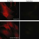 Phospho-Coronin 1B (Ser2) Antibody in Immunocytochemistry (ICC/IF)