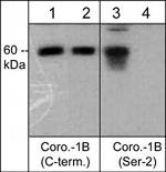 Phospho-Coronin 1B (Ser2) Antibody in Western Blot (WB)