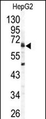 Arylsulfatase B Antibody in Western Blot (WB)