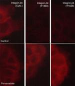 Phospho-CD104 Integrin beta 4 (Tyr1526) Antibody in Immunocytochemistry (ICC/IF)