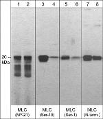 Phospho-MYL12A (Ser1) Antibody in Western Blot (WB)