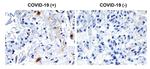 SARS-CoV-2 NSP2 Antibody in Immunohistochemistry (Paraffin) (IHC (P))