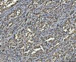 hnRNP U Antibody in Immunohistochemistry (Paraffin) (IHC (P))