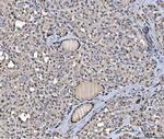 hnRNP U Antibody in Immunohistochemistry (Paraffin) (IHC (P))