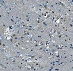 DNAJC6 Antibody in Immunohistochemistry (Paraffin) (IHC (P))