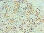 MAGE1 Antibody in Immunohistochemistry (Paraffin) (IHC (P))