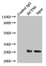 DCTN6 Antibody in Immunoprecipitation (IP)