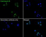 Calcineurin B Antibody in Immunocytochemistry (ICC/IF)