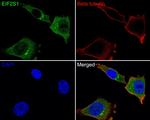 EIF2S1 Antibody in Immunocytochemistry (ICC/IF)