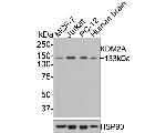 KDM2A Antibody in Western Blot (WB)
