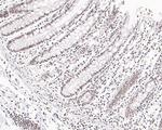 TBP Antibody in Immunohistochemistry (Paraffin) (IHC (P))