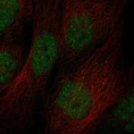 ZBTB46 Antibody in Immunocytochemistry (ICC/IF)