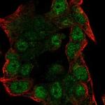 NFAT5 Antibody in Immunocytochemistry (ICC/IF)