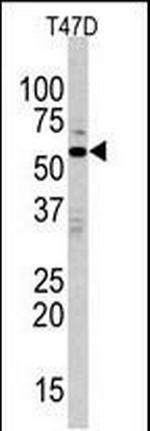 MAPK15 Antibody in Western Blot (WB)