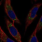 BST-2 Antibody in Immunocytochemistry (ICC/IF)