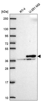Calponin 2 Antibody in Western Blot (WB)