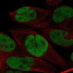 BRD3 Antibody in Immunocytochemistry (ICC/IF)