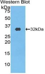 PIK3C2B Antibody in Western Blot (WB)