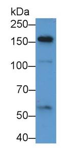 A2ML1 Antibody in Western Blot (WB)