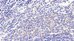 MTCO2 Antibody in Immunohistochemistry (Paraffin) (IHC (P))