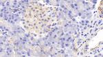 MTCO2 Antibody in Immunohistochemistry (Paraffin) (IHC (P))