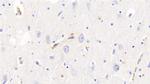 Hemoglobin Antibody in Immunohistochemistry (Paraffin) (IHC (P))