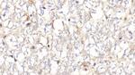 Hemoglobin Antibody in Immunohistochemistry (Paraffin) (IHC (P))