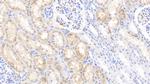 Hemoglobin Antibody in Immunohistochemistry (Paraffin) (IHC (P))