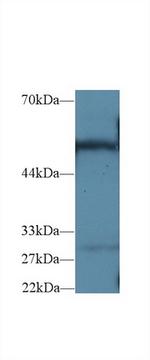 G6PD Antibody in Western Blot (WB)