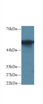 G6PD Antibody in Western Blot (WB)