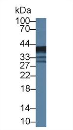 ABHD7 Antibody in Western Blot (WB)