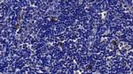 Tryptase Antibody in Immunohistochemistry (Paraffin) (IHC (P))