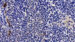 Tryptase Antibody in Immunohistochemistry (Paraffin) (IHC (P))