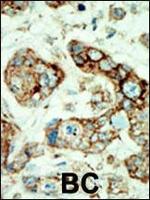 EphA2 Antibody in Immunohistochemistry (Paraffin) (IHC (P))