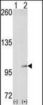 EphA4 Antibody in Western Blot (WB)