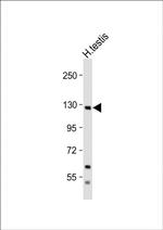 EphA6 Antibody in Western Blot (WB)