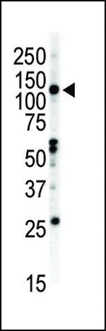 EphB2 Antibody in Western Blot (WB)