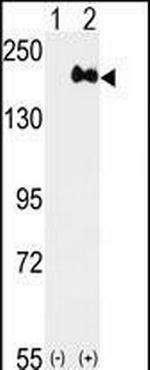 ErbB2 (HER-2) Antibody in Western Blot (WB)