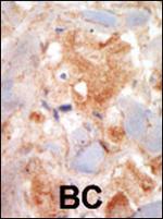 c-Kit Antibody in Immunohistochemistry (Paraffin) (IHC (P))