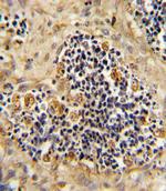 ROR2 Antibody in Immunohistochemistry (Paraffin) (IHC (P))