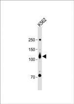 ROR2 Antibody in Western Blot (WB)