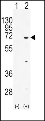 TXK Antibody in Western Blot (WB)