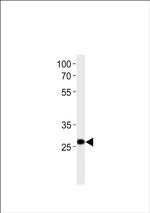 PDX1 Antibody in Western Blot (WB)