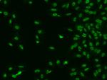 CTDSP2 Antibody in Immunocytochemistry (ICC/IF)