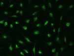 DDX56 Antibody in Immunocytochemistry (ICC/IF)