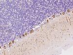 NBPF15 Antibody in Immunohistochemistry (Paraffin) (IHC (P))