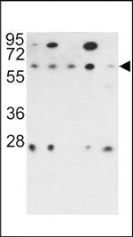 PPP2R3B Antibody in Western Blot (WB)