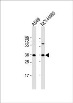 CTGF Antibody in Western Blot (WB)